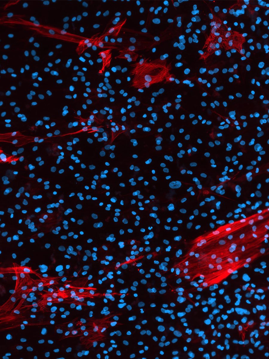 FAP cells2 tall_web
