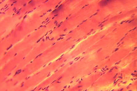 MuscleCells-3